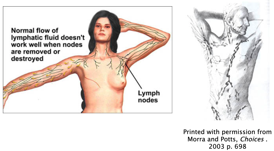 Lymphedema Anatomy