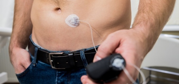 Diabetic man with Insulin Pump